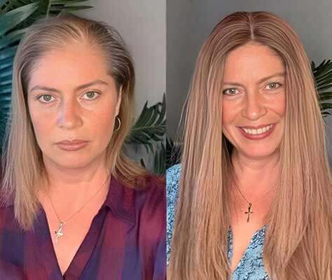 Resultado da cliente antes e depois do Growy