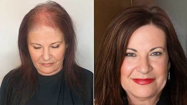 Antes e depois da Camila usando Growy