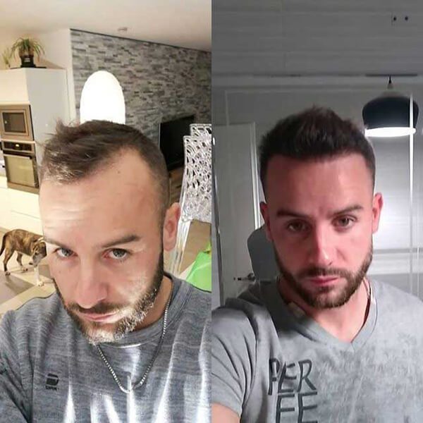 Resultado Growy - homem